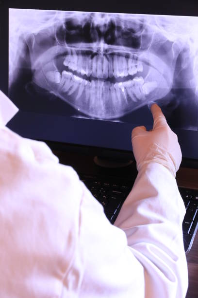 Best Emergency Root Canal Treatment in La Paloma, TX