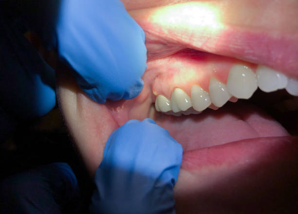 Best After-Hours Emergency Dentist in La Paloma, TX