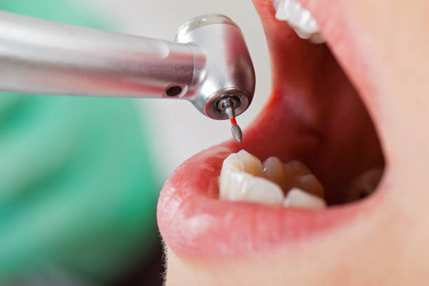 Best Weekend Emergency Dentist in La Paloma, TX